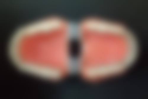 北京京大博爱口腔门诊部做韩国奥齿泰种植牙的医生优势