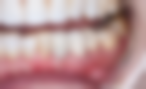 四、中山康顺口腔诊所特色项目