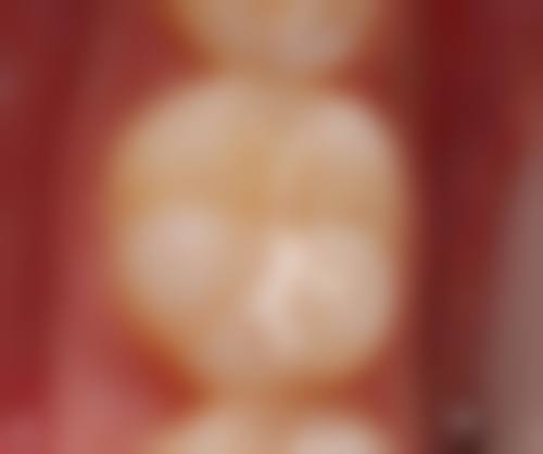 五、深圳青苗儿童口腔(第壹海内外广场店)收费价格表