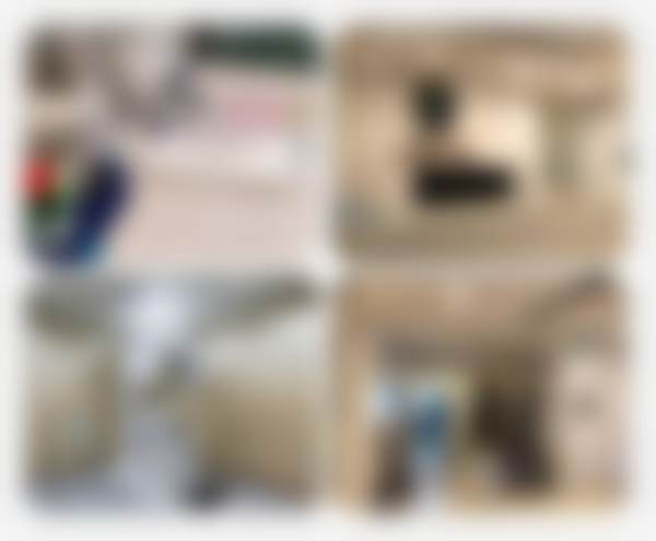 正畸治疗开始，过程舒适无压力