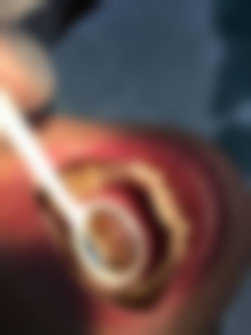 四、温州瑞安叶阿波口腔特色项目