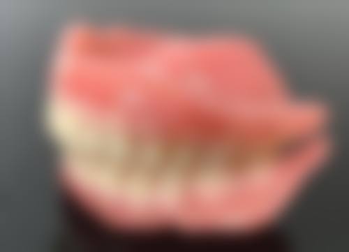 影响根管治疗前是否消炎的因素