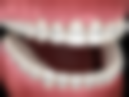 六、平城区楚璇钱淑雅医生口碑评价及真人实例反馈