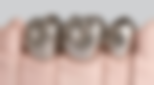 专精拔牙的优势