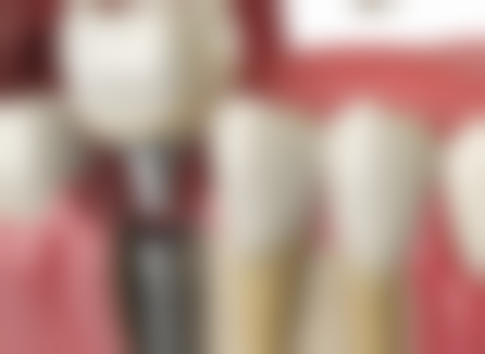 四、吉林长春青尚口腔特色项目