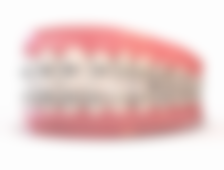 地包天会造成什么影响？它不仅影响容貌、心理，还会波及咀嚼、发音、牙颌发育和口腔健康！ 