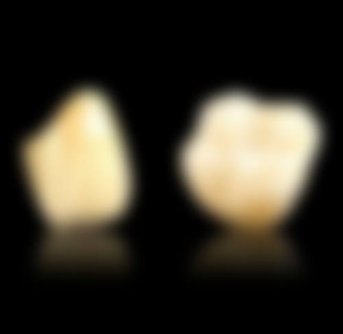 四、吉安皓靓口腔特色项目