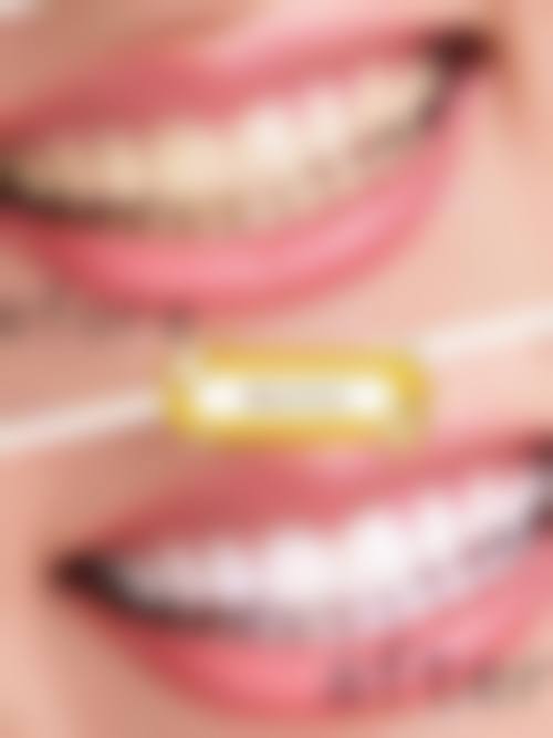 四、重庆泰康拜博口腔(永川口腔)特色项目