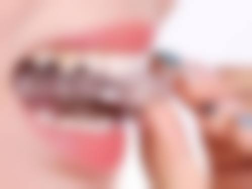 四、大连朗朗嘉瑞口腔诊所特色项目