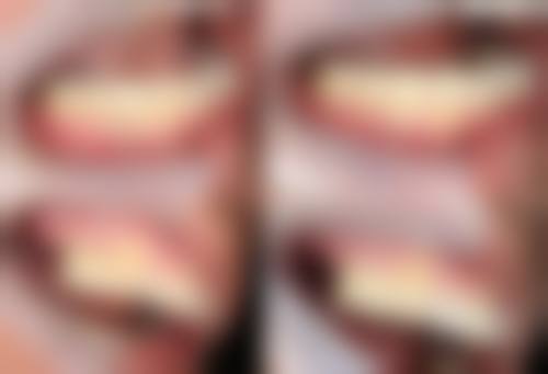 五、伊春伊美松鼠口腔门诊部收费价格表