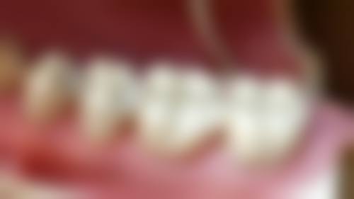 四、秦皇岛张媛媛口腔诊所特色项目