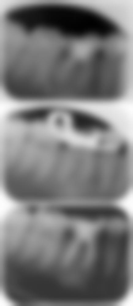 五、湖南长沙刘世权雅雅口腔诊所收费价格表