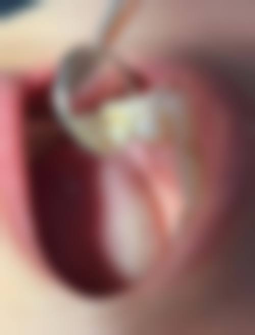 六、新余牙典口腔门诊部(渝水区)口碑如何？