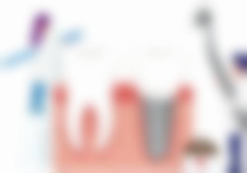 四、温州鹿城单丹口腔诊所特色项目