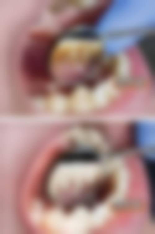 五、温州鹿城单丹口腔诊所收费价格表