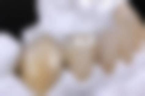 八、上海惠恒口腔怎么预约？