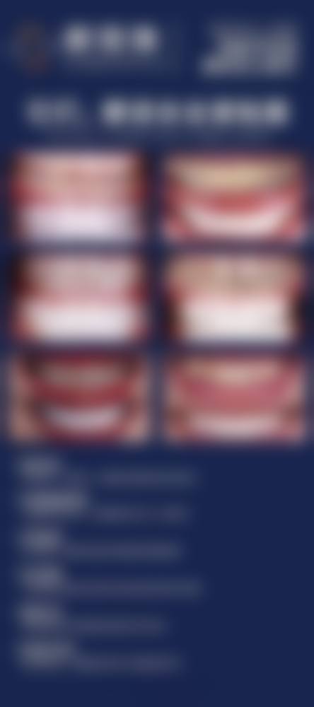 四、广州陈倩口腔诊所特色项目