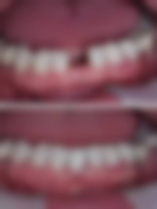 五、上海摩尔星达口腔门诊部收费价格表