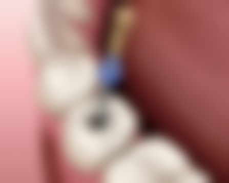 八、贵州毕节赫章牙小生口腔怎么预约？