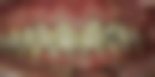 四、好牙众享口腔诊所（市中总院）特色项目