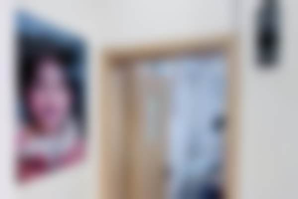 赣州青檬口腔诊所爱尔创牙冠的强度表现