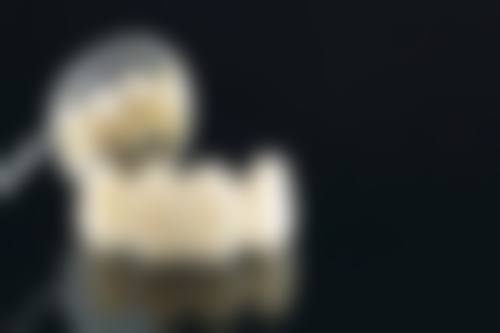 洗牙结石后异常情况处理注意事项