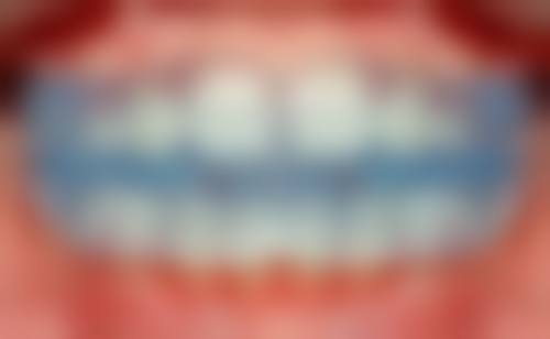 六、格莱美整形口腔医院口碑如何？