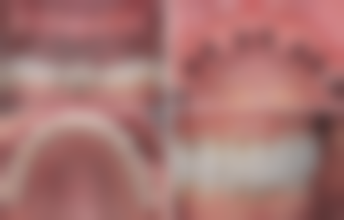 八、福建厦门六月微笑口腔(厦门湖里分店)怎么预约?