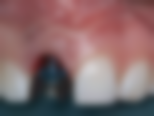 四、南京洁宇口腔特色项目