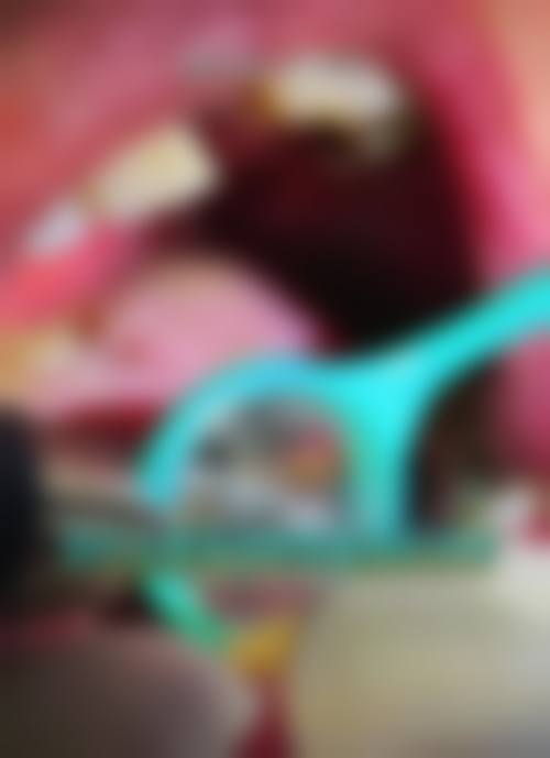 四、吕梁张兰荣口腔诊所(新科技口腔)特色项目