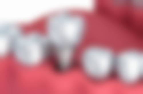 六、大庆世同口腔口碑如何？