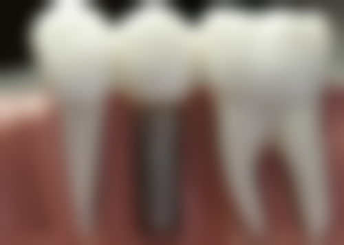 三、湖北荆州灵芝口腔医生介绍