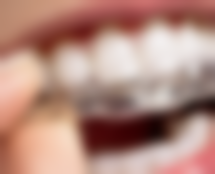 四、三门峡靳旭周口腔诊所特色项目