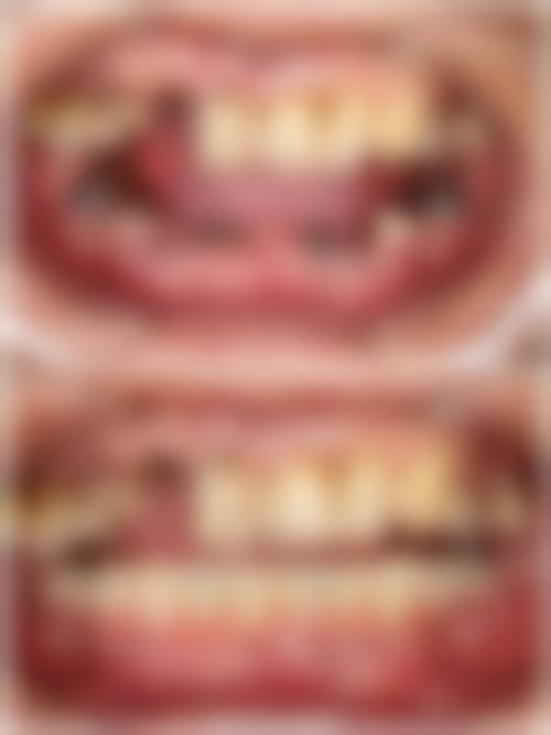 四、广州卢林凤口腔门诊部特色项目