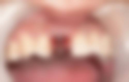 六、陕西安康汉阴牙邦口腔口碑如何?
