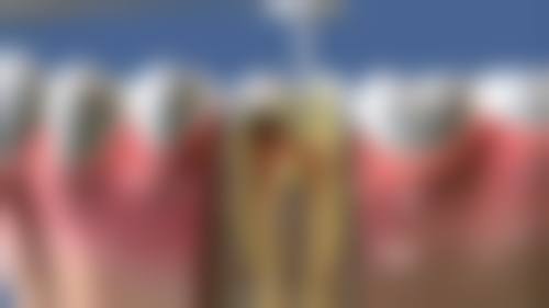 六、资阳乐至海豚口腔口碑如何?