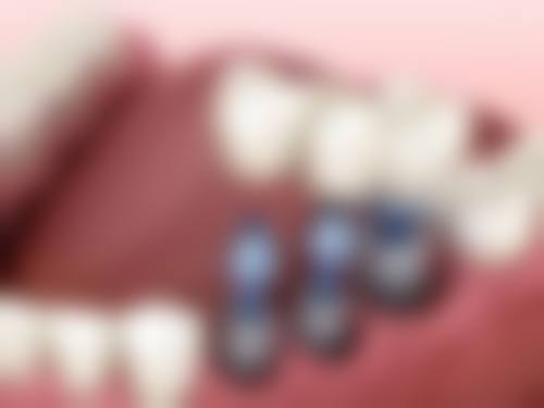 六、广东东莞沙田未来口腔门诊部口碑如何?