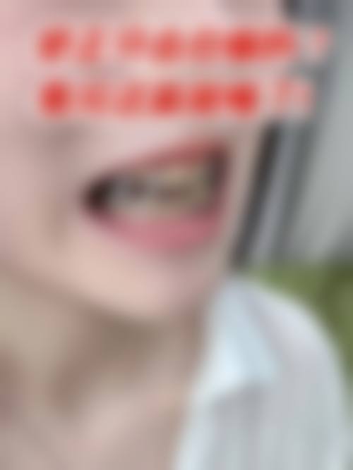八、重庆渝北美尔康口腔怎么预约?