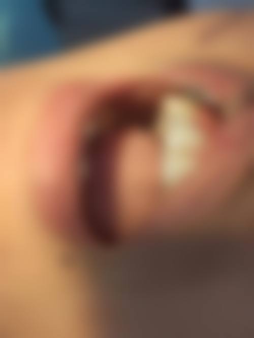 六、湖州长兴微笑口腔门诊部(虹星桥分院)口碑如何？