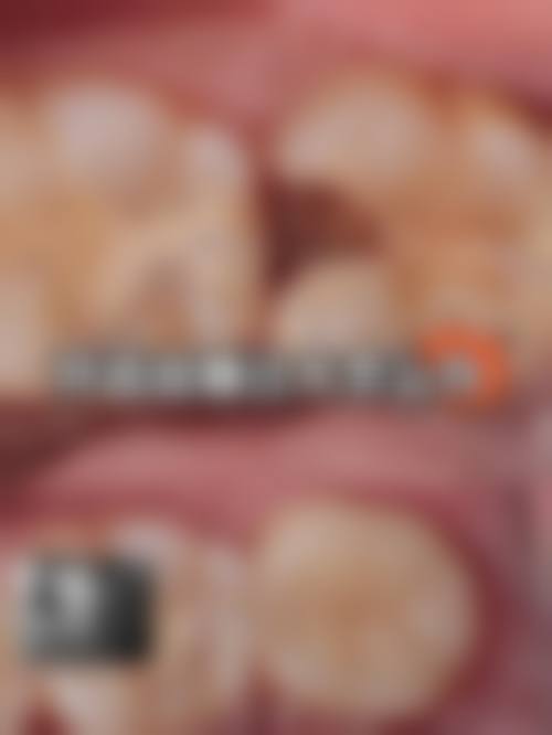 二、温州乐清皓齿口腔正规吗?来看医院资质信息