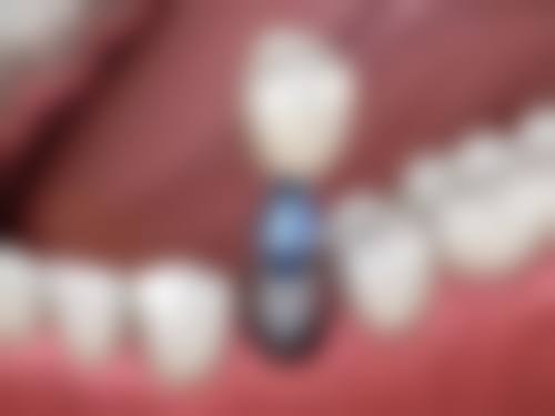 七、内蒙古包头品众口腔门诊部地址电话及营业时间