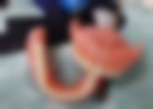 六、上海沐良诚口腔李屹医生口碑评价及真人实例反馈