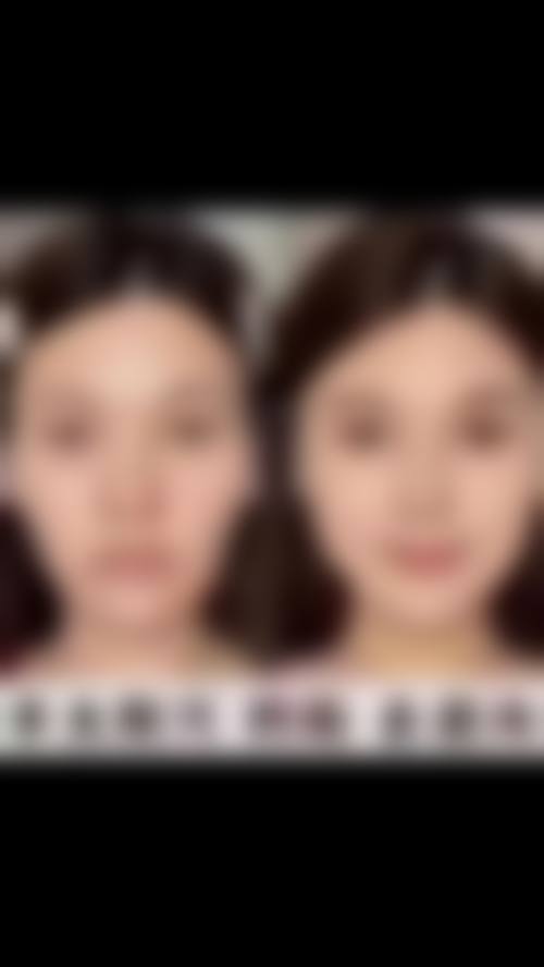 许昌市中 心医院整形美容科就诊流程与服务说明