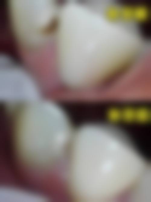 五、重庆博莱口腔(江北店)收费价格表