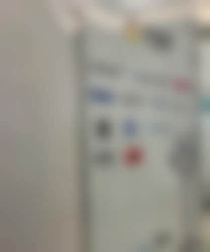 成人长期正畸成效:坚持带来的惊喜改变