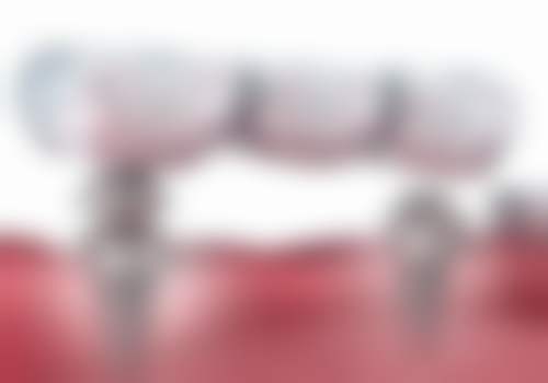 八、广东广州博仁口腔怎么预约?