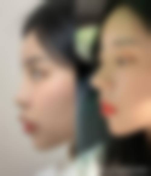 擅长项目详解