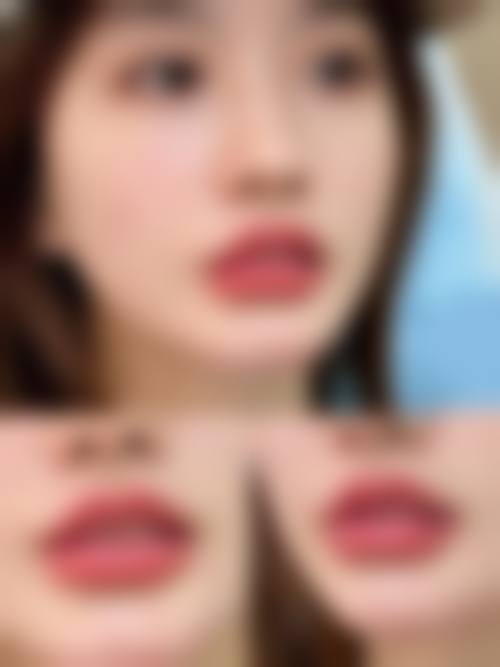 临床实例分享