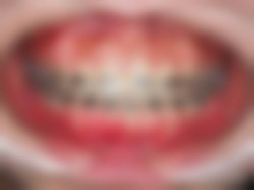 FAQ:常见问题解答