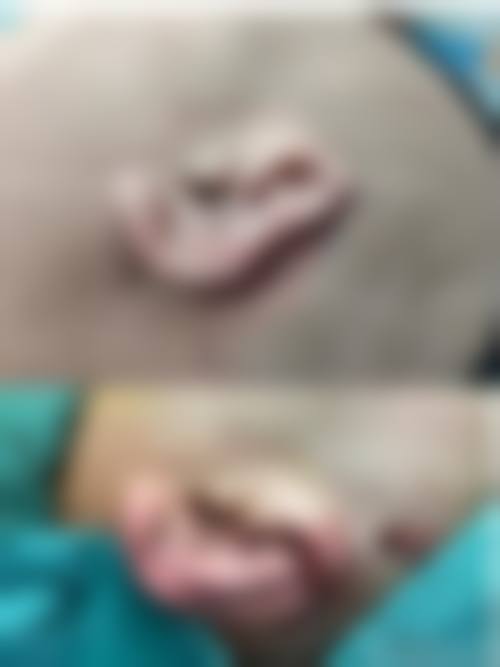 患者真实评价